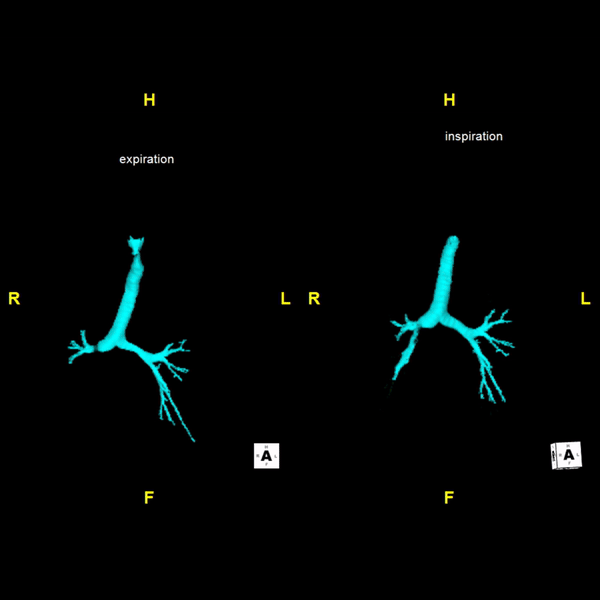 Airway Assessment
