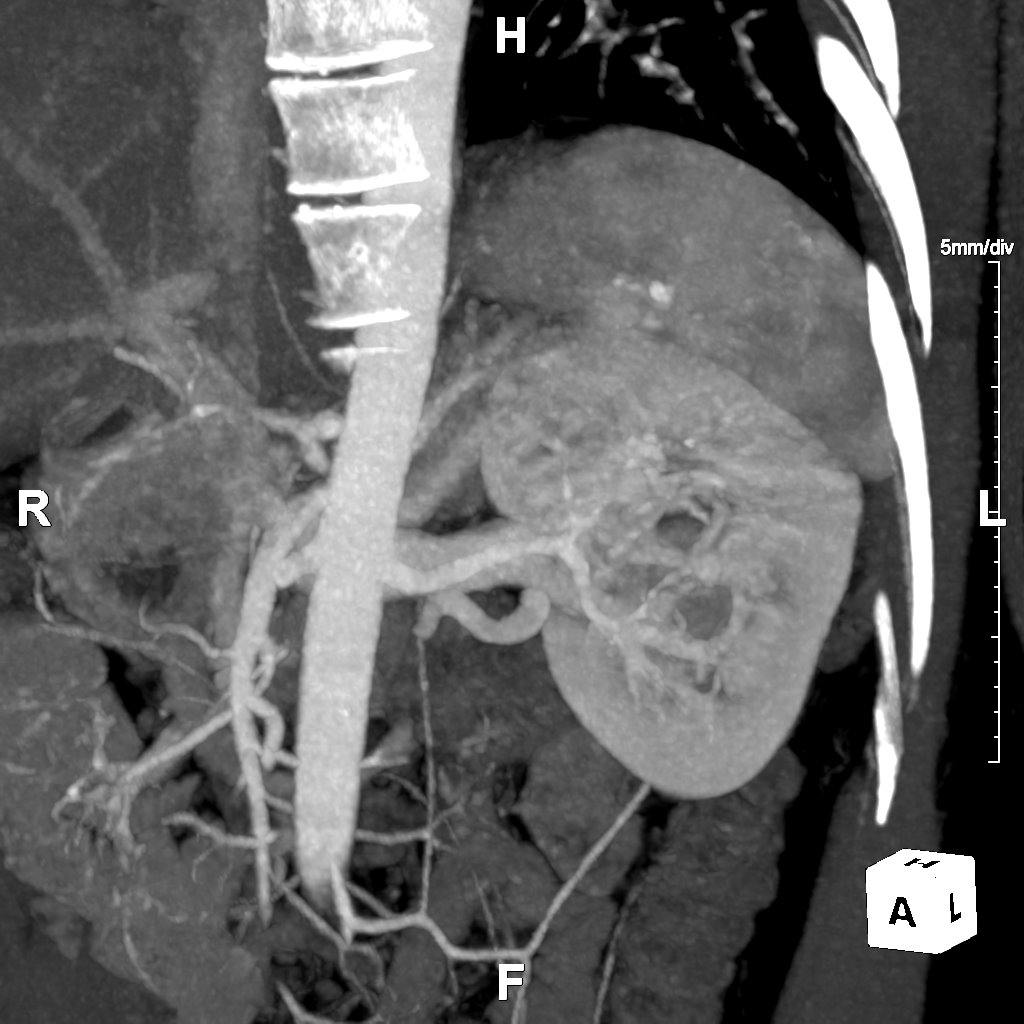 Routine Chest-Abdomen-Pelvis